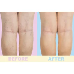 Online Tempsl Gel soin des jambes