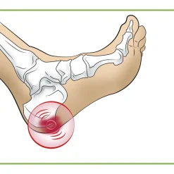 Best Tempsl Talonnettes pour épine calcanéenne Modèle femme